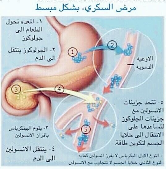 مرض السكرى بشكل مبسط CgE88l8W8AAMKCk