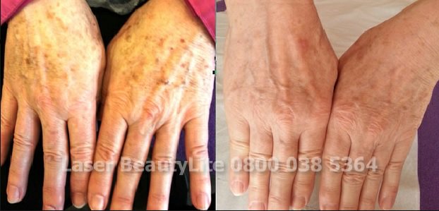 HelloLaser's tweet image. When it's miserable and wet you could still be having fun with me!