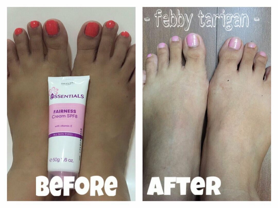 Bisa jg buat ngilangin belang di kaki..Di tangan apalagi yaa kalo gt..Buat cwek2 yg sering naik motor perlu bngt nii