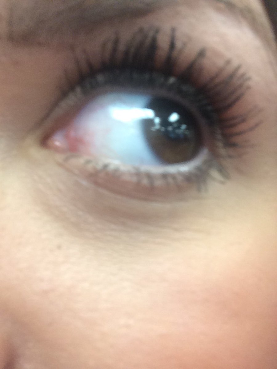EyeZoeyleft's tweet photo. Eye hope you have a great weekend 😜😍😍😍😍😍 #eyeisyou #friday https://t.co/JtOey99aju