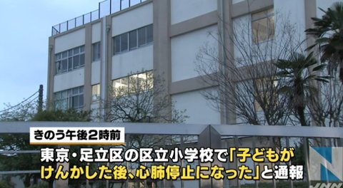 秀丸 参上 Twitter Da いじめ事件 足立区青井小学校4年生 意識不明の重体 加害者の同級生がヤバすぎ 画像あり 2ch 殺人未遂事件だろ 助かっても後遺症残りそう T Co Q1uhb0qu62