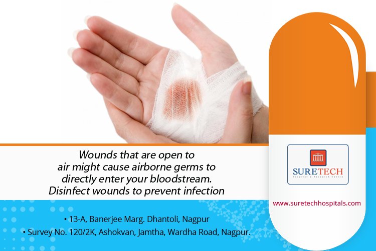Tweet_Suretech's tweet photo. Open wounds should be disinfected as soon as possible. #Suretech https://t.co/NSt2AcWaBp