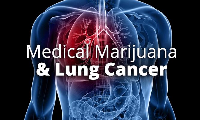 Cannabidiol (CBD) May Increase Lung Cancer's Susceptibility To Specialized Killer Cells bit.ly/1AWKT9e