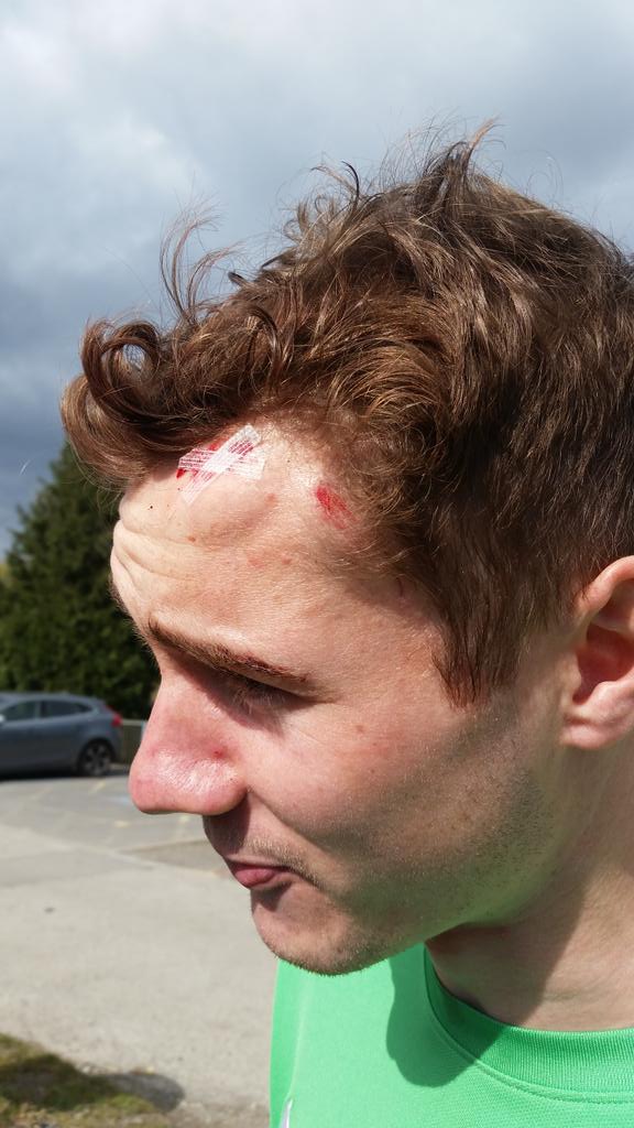 Special mention today to stand in goalkeeper <a href="/TongEdtong/">Ed Tong</a> for putting his head on the line for the team 💪 #painfulone