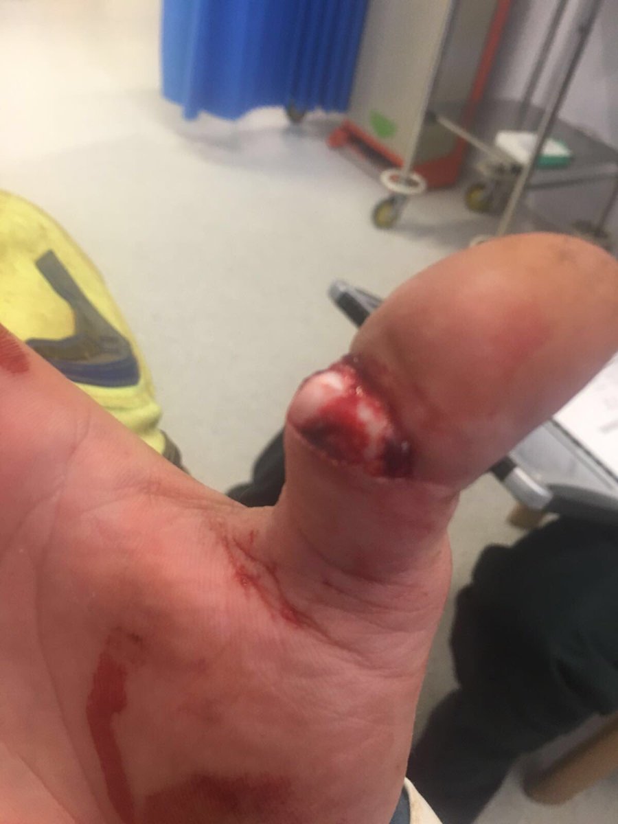 Hard as nails <a href="/Jay78840205/">Jay</a> 👊🏻✊🏻