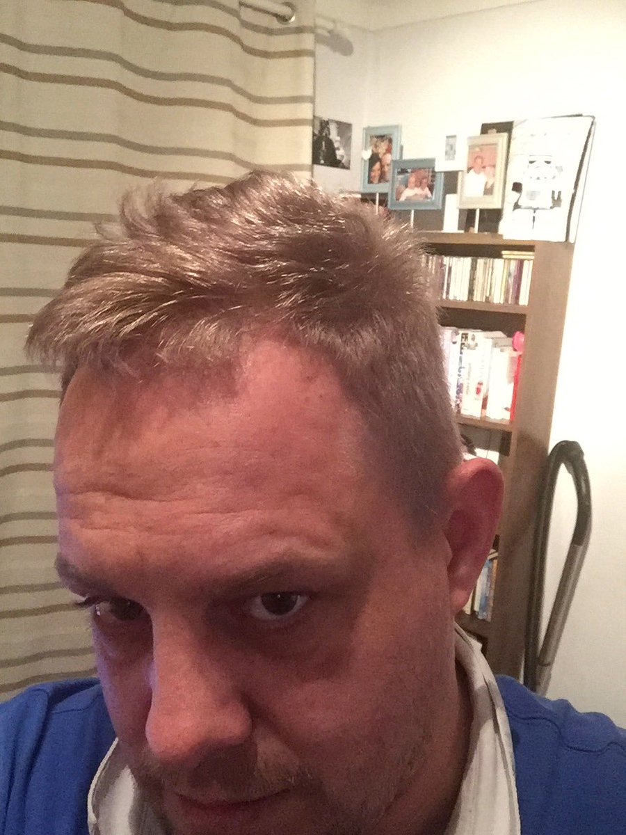 superallie10's tweet photo. @RickyRayment after two weeks and eight dyes almost nailed it https://t.co/QQ4W4IN2dq