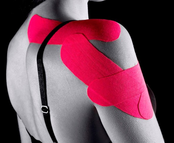 intertaping_com's tweet photo. Aplicación de estabilización del Hombro / Shoulder stabilization #Intertaping #kinesiotaping #Taping https://t.co/NoCvmYHGV4