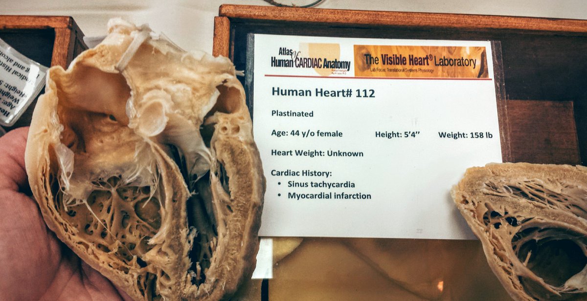atosine's tweet photo. Great time at #dmdconf this year and it was topped off by holding real human hearts! https://t.co/3llymWK2c0