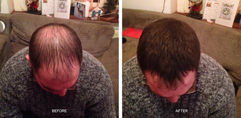 #KERAFIBER CAN! Thank you for these before &amp; after pictures.
Please share your before &amp; after pictures on our page!