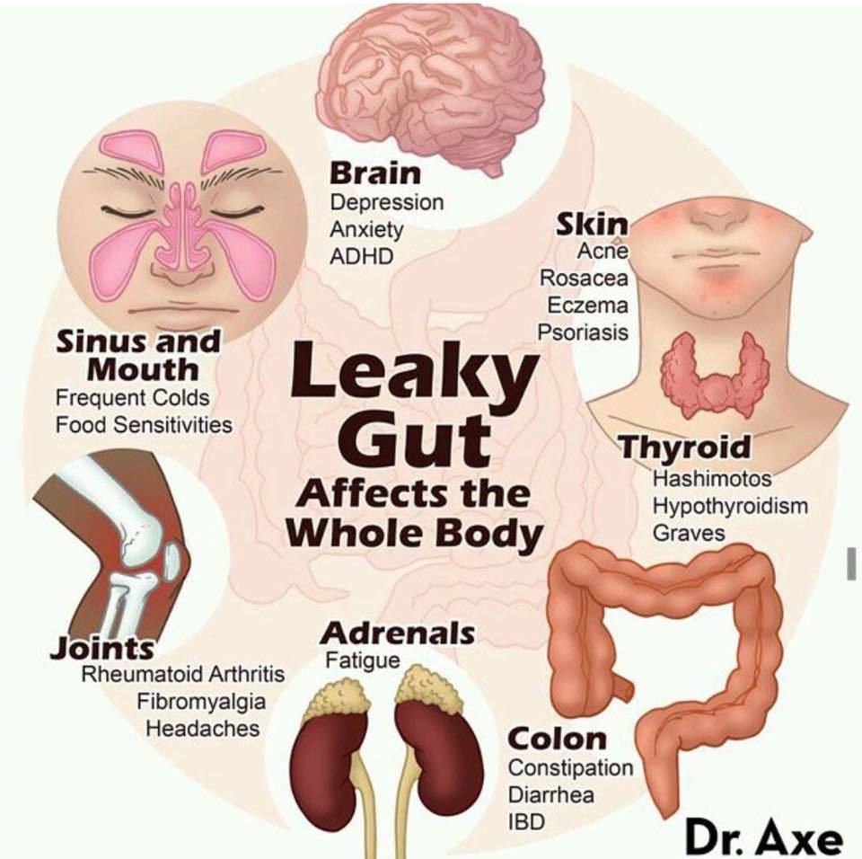 jomroach54's tweet image. Anyone else suffer from leaky gut?
Ohhh wow!! I had no idea!!! So thankful for Plexus Triplex!!!