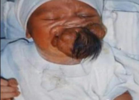 wake up on twitter tv surge in babies being born with extra arms