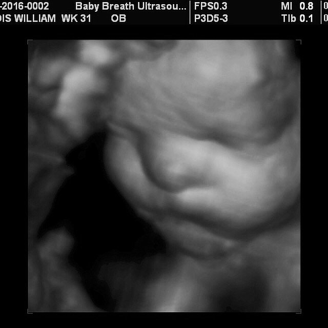 3d Baby Ultrasound breath1 Twitter