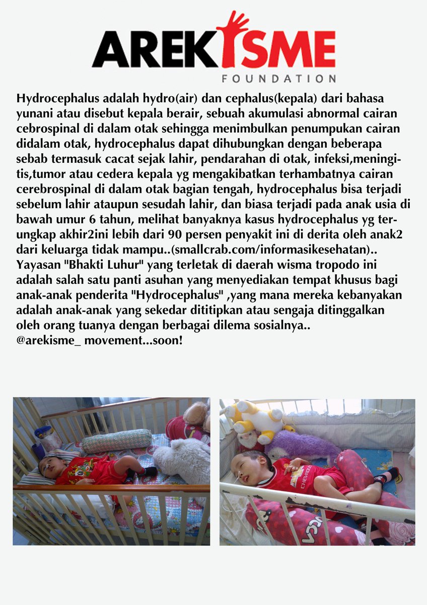 #HYDROCEPHALUS #FUNDISTORTIONMOVEMENT #AREKISME