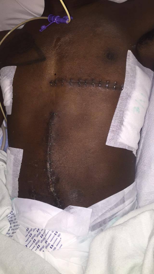 realUAPB's tweet photo. Abdi may be paralyzed by the cop shooter. The family doesn't have the footage. Rally Sat @ 4 https://t.co/Sq5yo20jOh https://t.co/kzsgyWsuSq