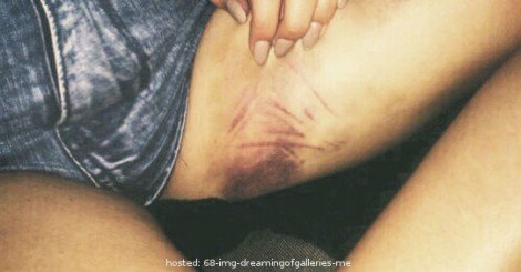 A Mom Posted This Graphic Photo On Facebook. She Never Imagine Her Daughter's Response. 
 bit.ly/1WRzJCb