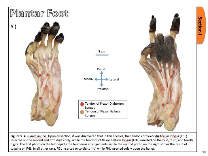 Dr Lissa Tallman On Twitter Muscle Variant My Student Found In A Baboon Foot As Part Of Her Comparative Anatomy Senior Honors Thesis So Proud Https T Co Iasr0y1h9z Twitter