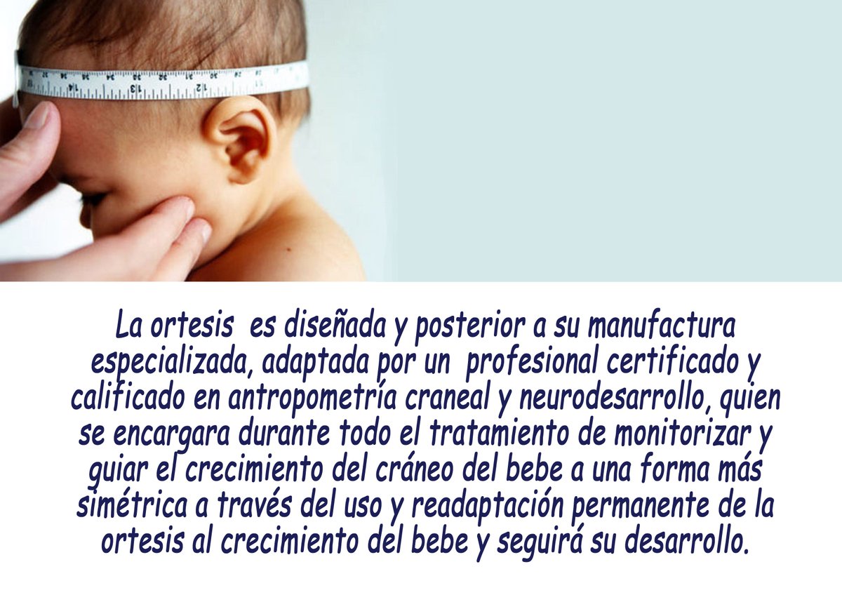 Positional skull deformities in children: skull deformation without synostosis | SpringerLink