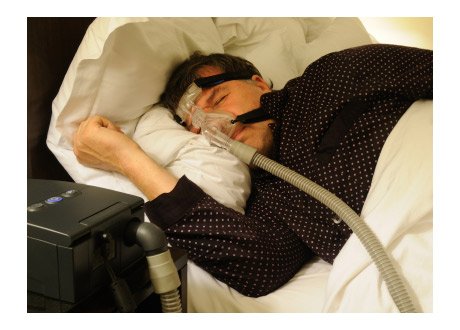 HelpMeSleepinfo's tweet image. Not everyone that snores has sleep apnea helpmesleepinfo.com/snoring-sleep-…