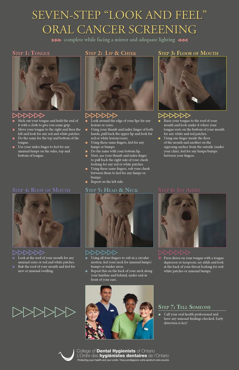 LorneParkDentl's tweet image. Seven-Step "Look and Feel" Oral Cancer Screening - Self Exam
#NationalOralHealthMonth #CDHO