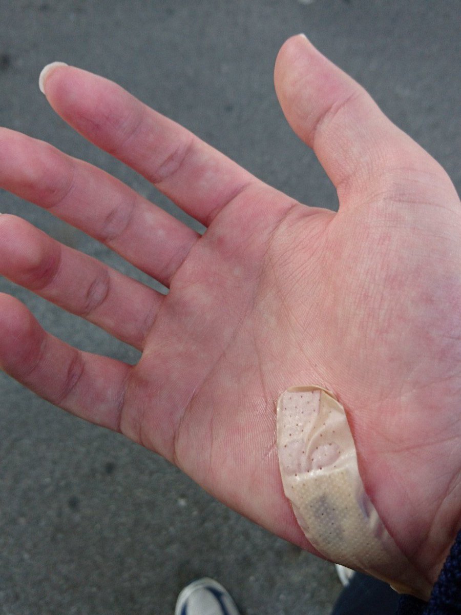 手怪我してるから痛い。今日の朝怪我したんだよね。