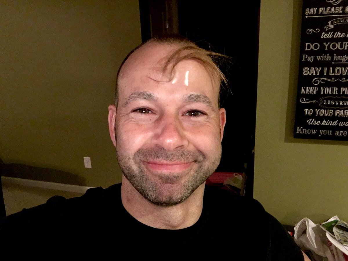 impractical jokers murr bald