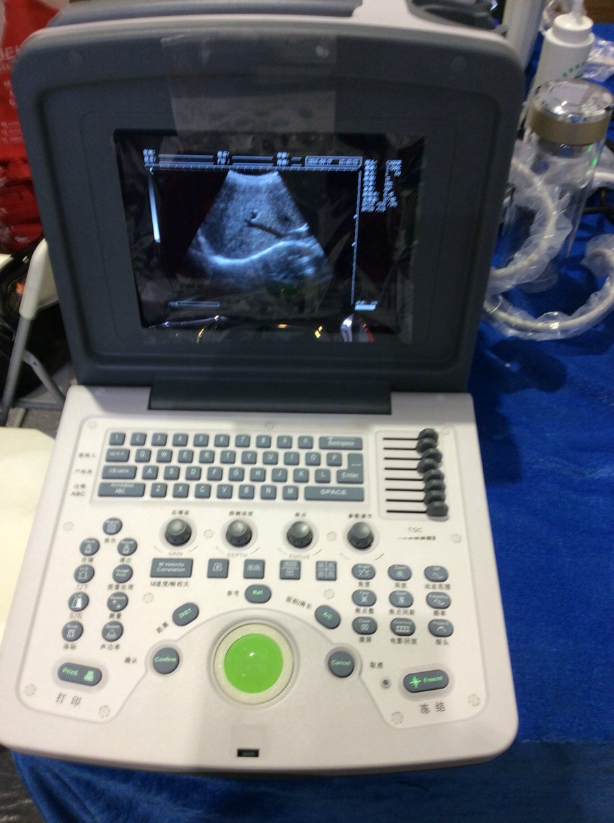 TonyUltrasound's tweet photo. newest 96 element ultrasound, will come into market the end of next month https://t.co/RifAjNgcWT