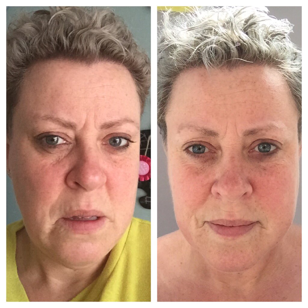 RedbournNamaste's tweet photo. Natural lift facial massage now booking! #fancyALift #holistic #facelift #redbourn #herts #stAlbans #namaste https://t.co/qPtWtHvuZx