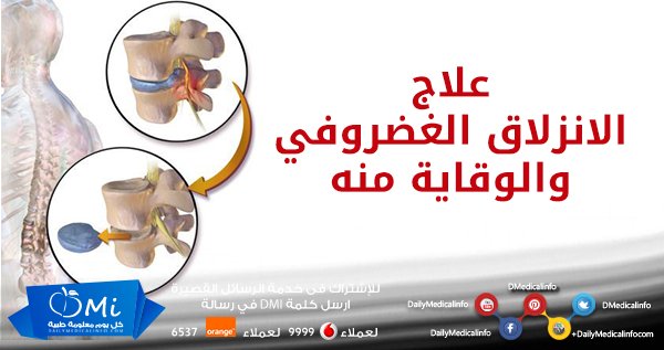 DMedicalinfo's tweet photo. علاج #الانزلاق_الغضروفي وطرق الوقاية منه
https://t.co/oY06FDvnle
#صحة #طب #علاج #وقاية #العمود_الفقري #��هر #فقرات https://t.co/WYRfhzbVcO