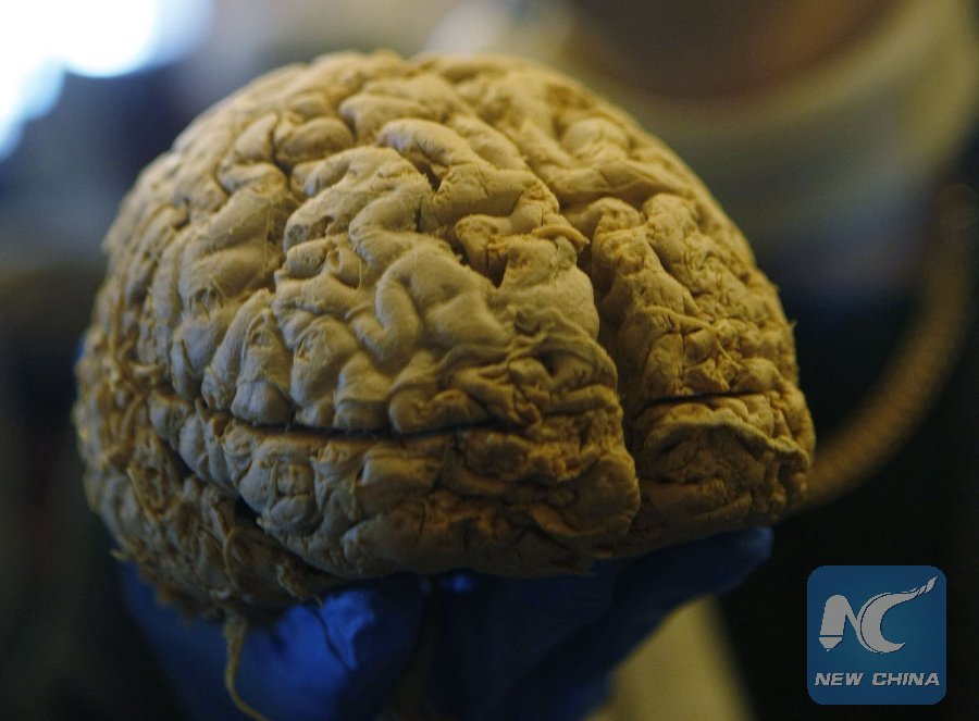 XHNews's tweet photo. Do you know how our brains perceive we're moving in a curvilinear trajectory? https://t.co/VkZJBnwtLC https://t.co/QGPFyEDjKH
