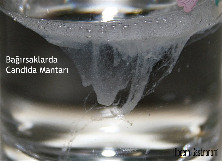 moderngastronom's tweet photo. https://t.co/2GH3FAP03f #bağırsak #mantar #candida Bağırsak florası ve Bağırsaklarda candida mantarı https://t.co/omIdxLRl6F