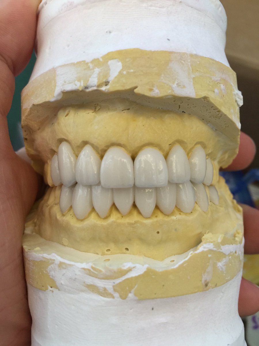 drandrewjkeller's tweet photo. Dr. Andrew Keller at Da Vinci Dental #bellevuedentist #cosmeticdentist #Veneers #bellevuecosmeticdentist https://t.co/gu1xj9GRH7