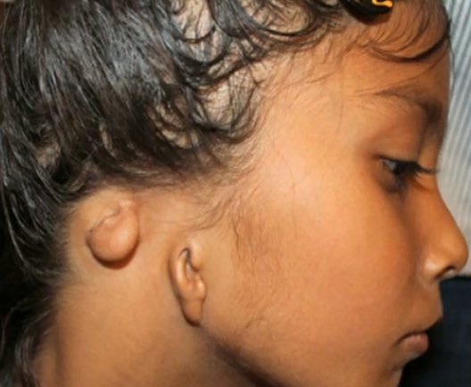 ivancorless's tweet photo. Happy Ear Day... #EarDay https://t.co/Ss27eOUA8t