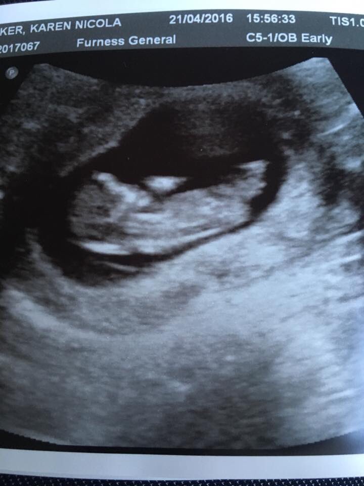 ChrisBarker_7's tweet photo. New member of #teambarker https://t.co/qVvK5gHTcZ