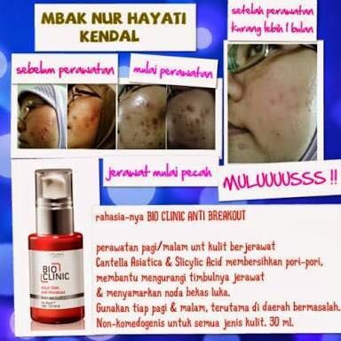 HdsAmelia's tweet photo. Katakan tidak pada jerawat ;) bio clinic dari oriflame ampuh mengatasi soal jerawat hanya 379k saja minat inbox yah https://t.co/sDxny5ebQn