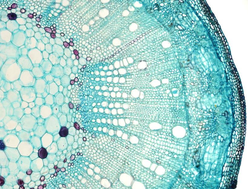 goop's tweet photo. Do you suffer from Polycystic Ovarian Syndrome (PCOS) and not even realize it?: https://t.co/8xIoi8Uy1N https://t.co/4i5libxIW3