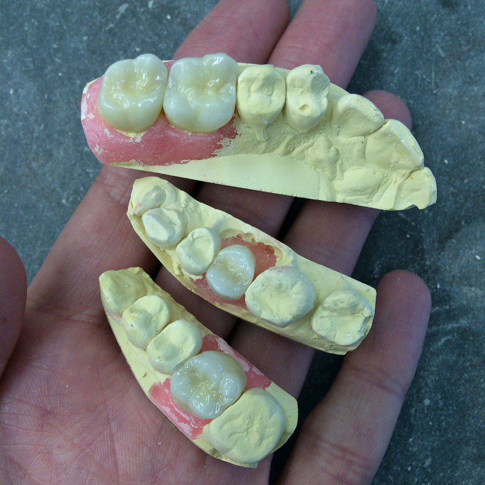 PoseyDentalLab's tweet photo. Some #zirconia #dentalcrowns. #poseydentallab #dental #dentistry #dentallab #dentaltech #dentalwork #3shape #dentist https://t.co/c2ob2kCdsc