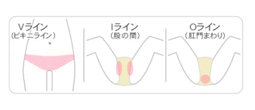 脱毛リアル On Twitter 女性のみなさんvio脱毛気になって 脱毛リアル On Twitter 女性のみなさんvio脱毛気になって
