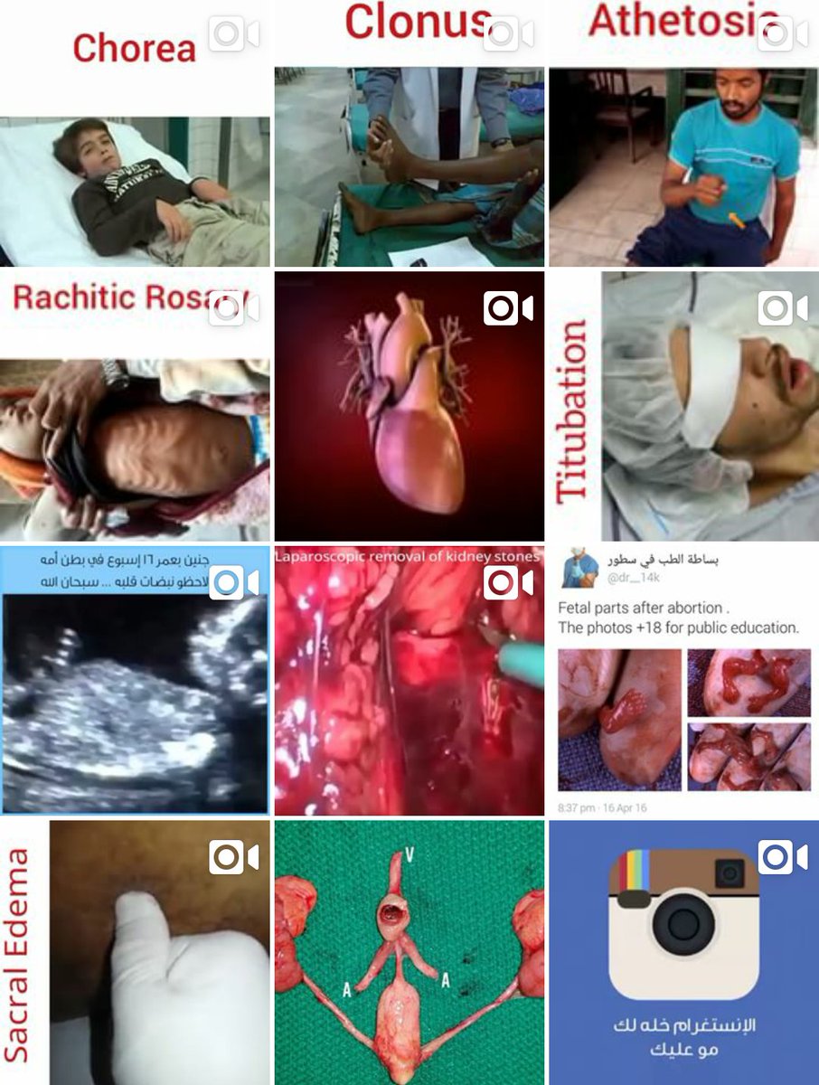 الطب ببساطة tweet media