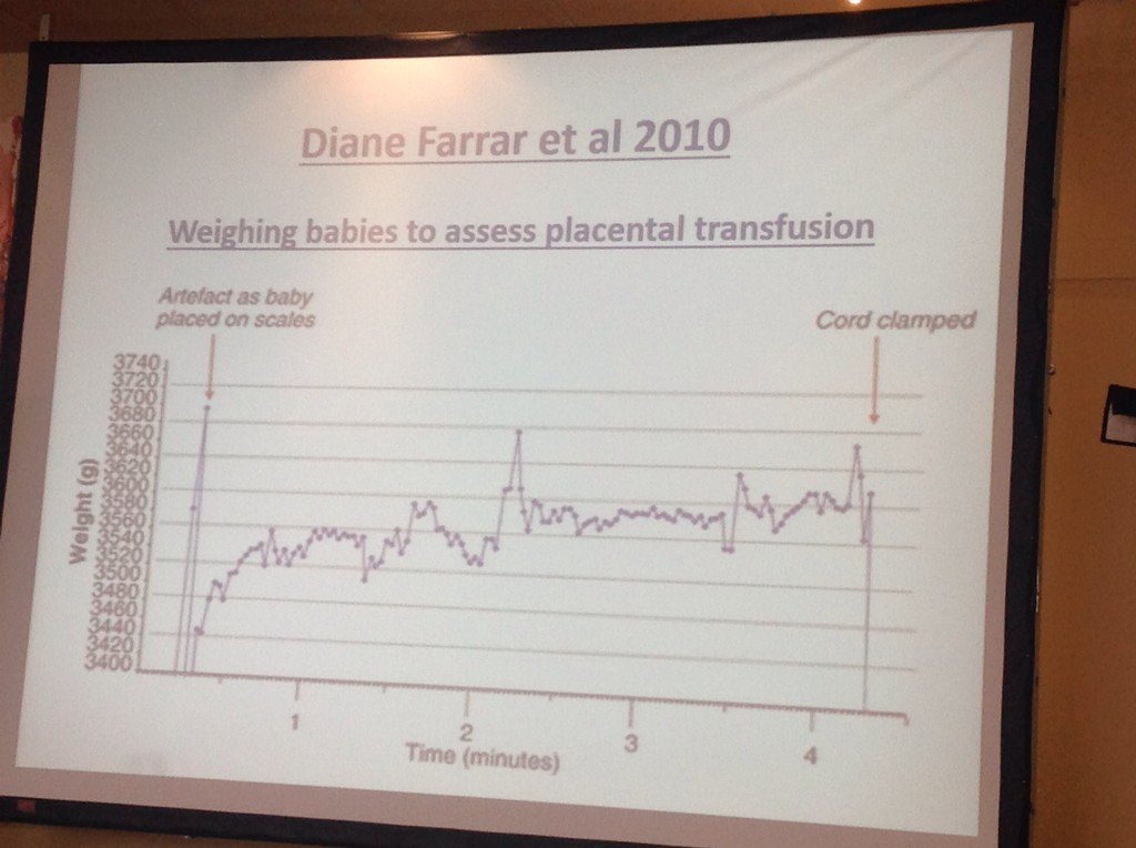 The baby gets bigger after it comes out of the vagina with optimal cord clamping #mama2016 <a href="/optimalclamping/">北京外 围/南京外 围/天津外 围/西安外 围/昆明外 围/上海外围/广州外围/深圳外围/无锡外围</a>