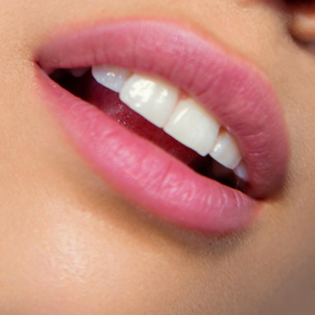 Perfect lips: we have the most qualified doctors and nurses to fulfil your desire for beautiful lips #fillers #lips
