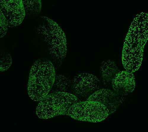 AlyssaHowardMD's tweet photo. Arabidopsis thaliana cells stably expressing genetically-encoded redox-sensitive biosensor - #geneticallyencoded https://t.co/XA9MbJ6omO