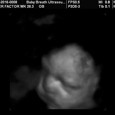 3d Baby Ultrasound breath1 Twitter