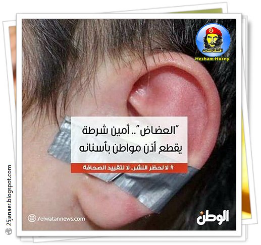 “العضاض”.. أمين شرطة يقطع أذن مواطن بأسنانه 