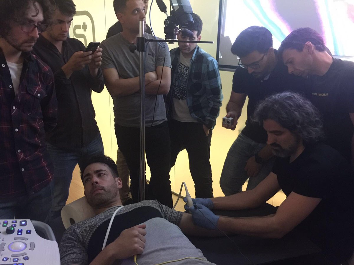 Continuamos en S-14 con #neuromodulación nervio radial #radialnerve #PENS #formacionpionera <a href="/primfisio/">PRIM Physio</a> <a href="/MVClinic/">MVClinic Institute</a>