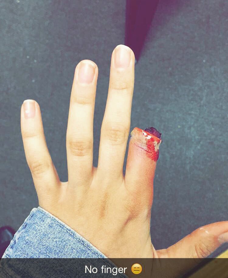 JordanHFarrell's tweet photo. Special effect Saturday 😉 no finger done with FX wax. 😁 #makeup #kryolan using all Kryolan. https://t.co/YBHqce11lH