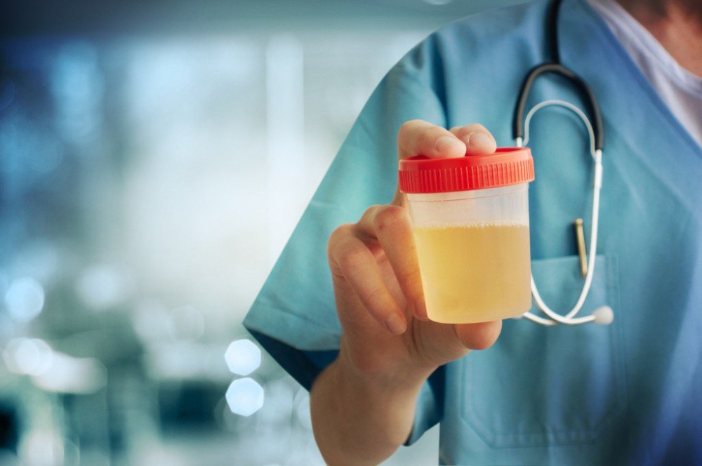 Arkansas governor quietly implements statewide drug tests for welfare applicants thkpr.gs/3765372
