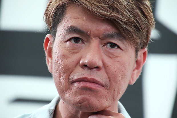 ライブドアニュース En Twitter 鳥肌 ヒロミ バイク事故後のビートたけしと会話し涙 T Co D6nrrwstea 偶然にもサウナで出くわし たけしは顔面麻痺にも関わらず 一生懸命ボケたそう ヒロミは オレ 涙出ちゃって これ話す度に鳥肌立つ