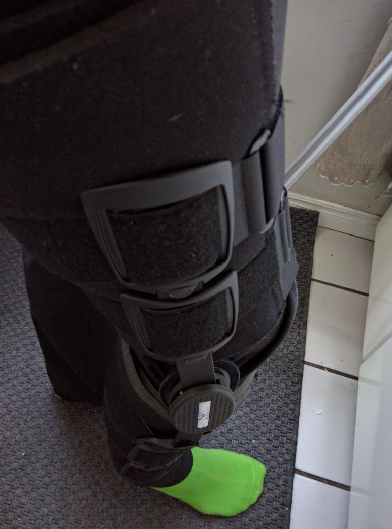 Look at the bend in that leg. Up to 15 degrees of flexion this week! 2 weeks to go they say.