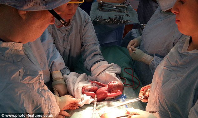 LifeNewsHQ's tweet photo. Parents Release Photo of Daughter Born at 24 Weeks to Stop Late-Term Abortions https://t.co/aJQTyRvuNP https://t.co/zYrX03VLEN