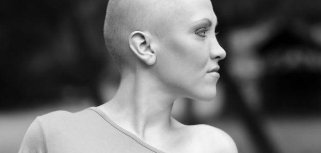 EcuavisaInforma's tweet photo. #LoMasVistoDeLaSemana 10 síntomas del cáncer que pueden pasar desapercibidos https://t.co/v9qvMAFWF3 https://t.co/sao5N7pTQ4